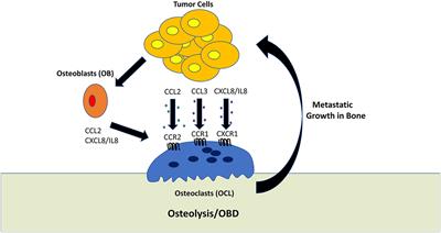 Role of Tumor-Derived Chemokines in Osteolytic Bone Metastasis